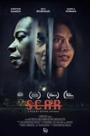 Scar